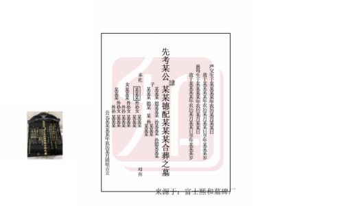 肠癌晚期有哪些典型症状-肠癌的晚期症状及表现网 | 肠癌的晚期症状及表现的治愈率高吗,肠癌的晚期症状及表现图片